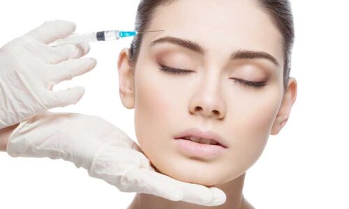 Botox tercio superior